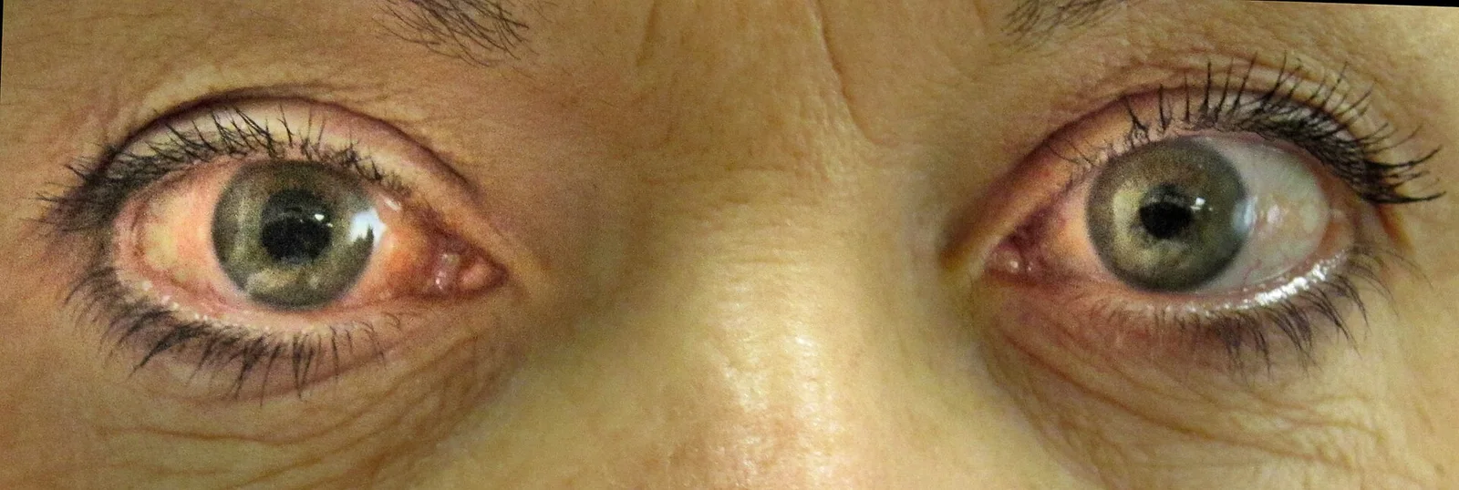 external photo study, the diagnosis is hidden until you answer