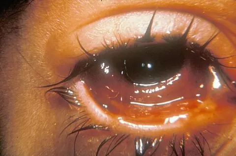 external photo image, diagnosis hidden