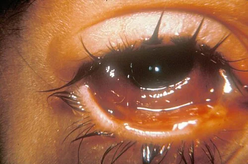 external photo image, diagnosis hidden