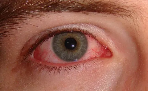 external photo image, diagnosis hidden