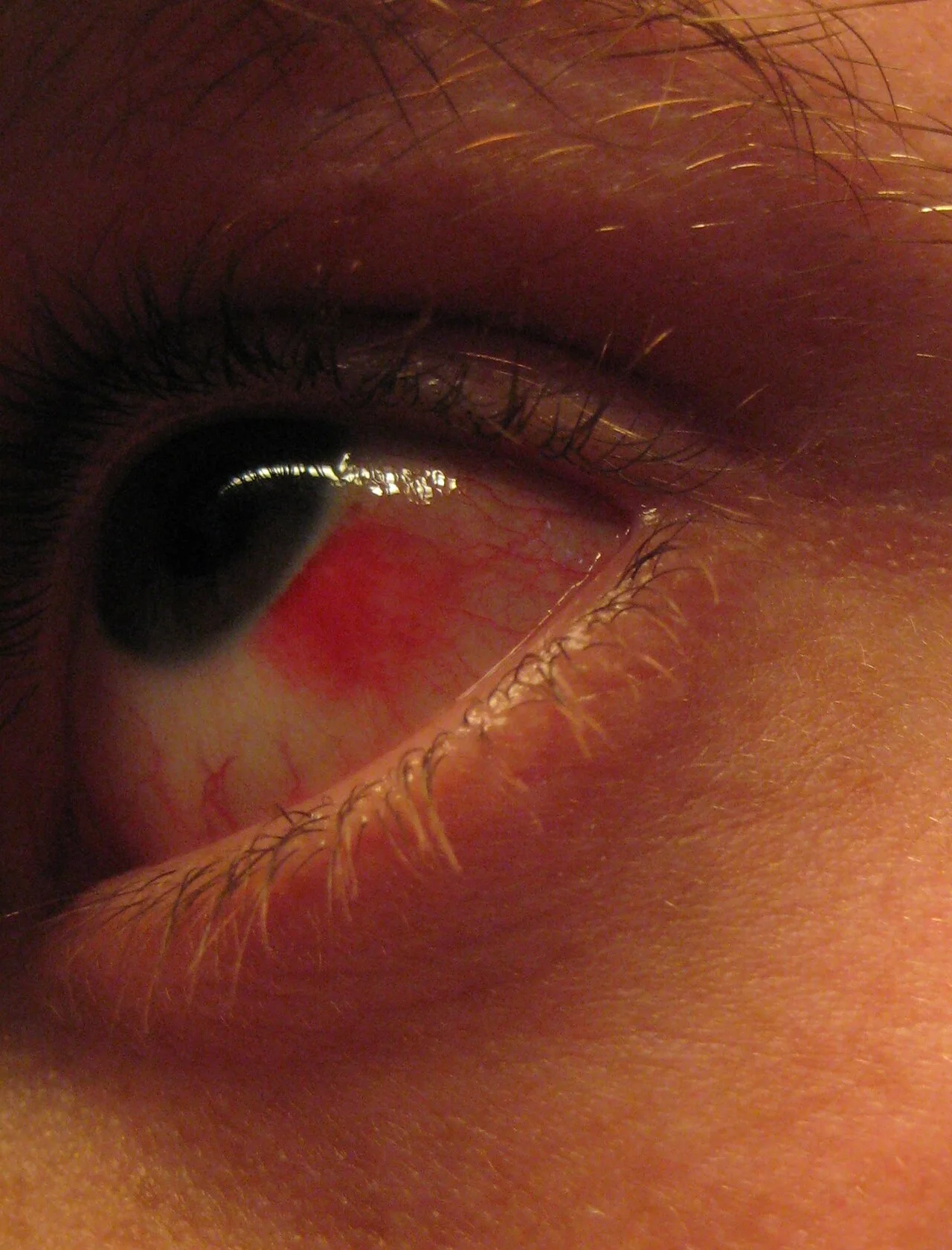 external photo study, the diagnosis is hidden until you answer