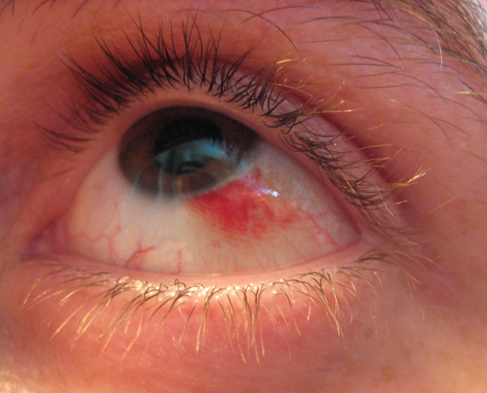 external photo study, the diagnosis is hidden until you answer