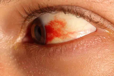 external photo image, diagnosis hidden