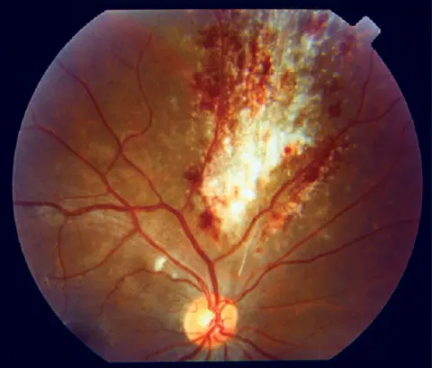 color fundus image, diagnosis hidden
