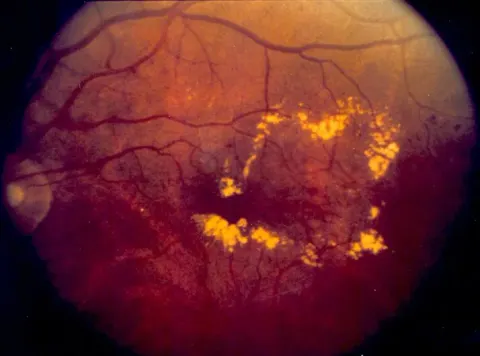 color fundus image, diagnosis hidden