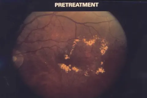 color fundus image with a text label from the source