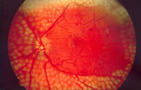 color fundus image, diagnosis hidden
