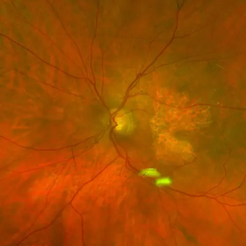 color fundus image, diagnosis hidden