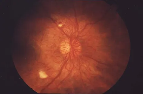 color fundus image, diagnosis hidden