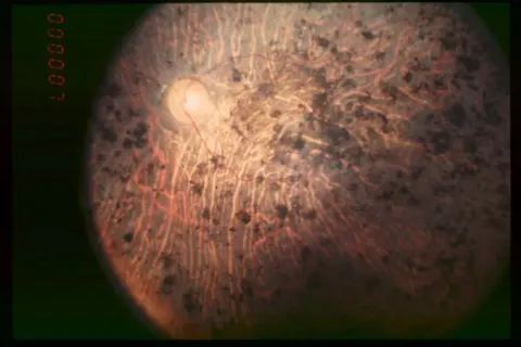 color fundus image, diagnosis hidden