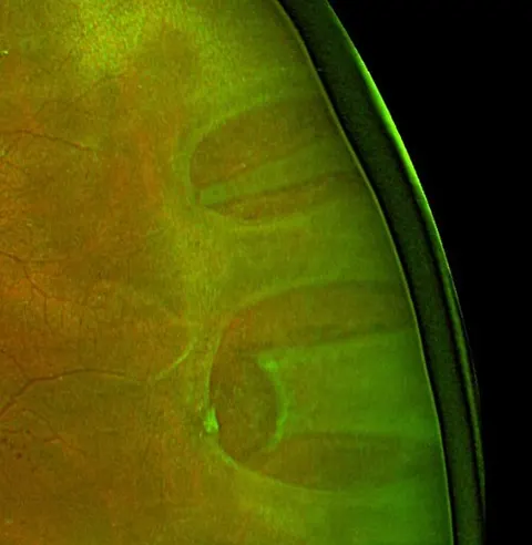 color fundus image, diagnosis hidden
